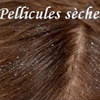 Pellicules sèches en hiver Clinique du Cheveu