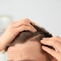 Les différents types de chute de cheveux